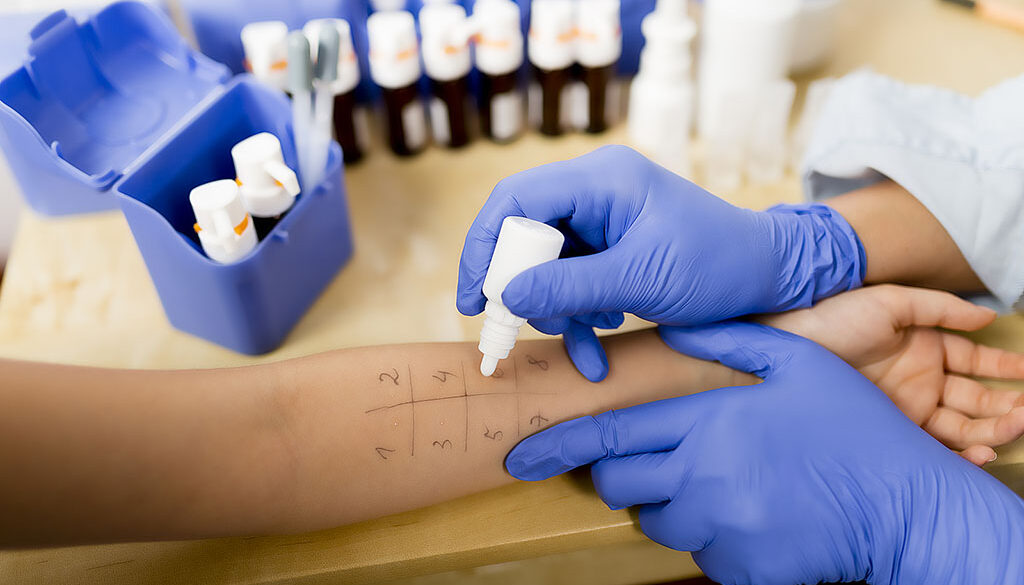 Closeup of a Doctor Applying a Solution to a Patient’s Arm During an Allergy Skin Test Do Allergy Skin Tests Hurt