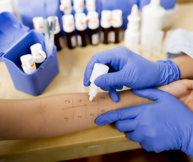 Closeup of a Doctor Applying a Solution to a Patient’s Arm During an Allergy Skin Test Do Allergy Skin Tests Hurt